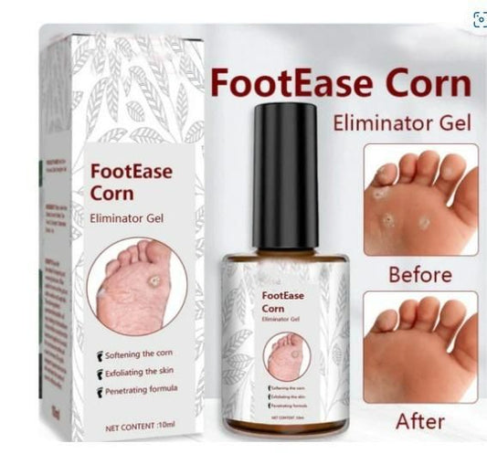 Feet Corn Removal Serum (30ml)