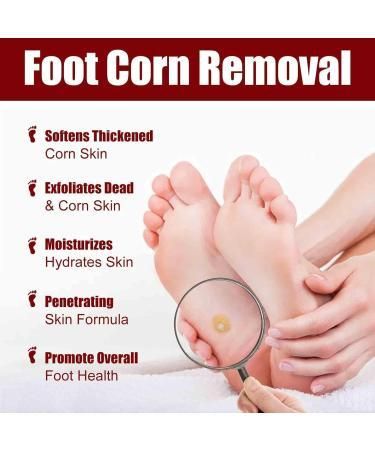 Feet Corn Removal Serum (30ml)